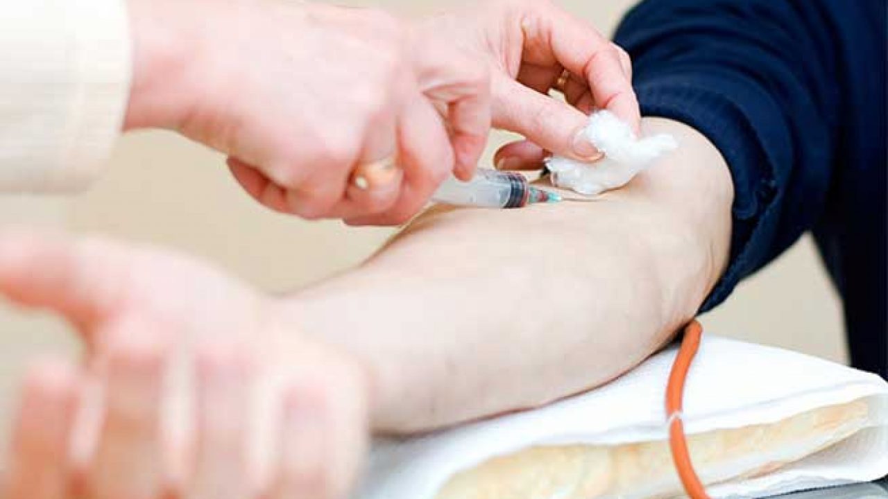 Costo Esami Del Sangue Per Artrite Reumatoide Cdi Milano Listino Prezzi Esami Del Sangue