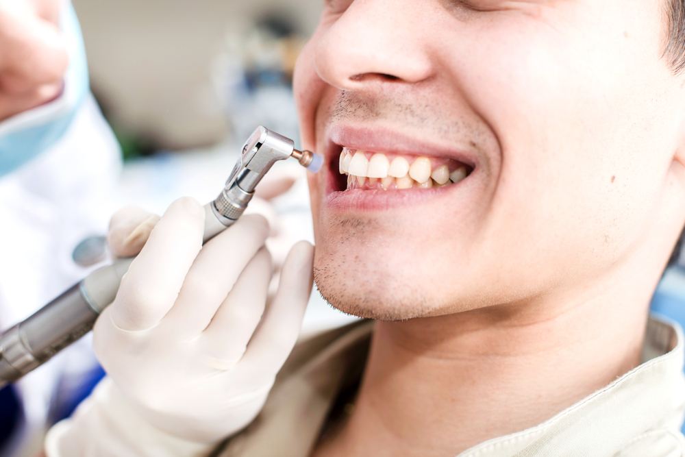 Come Si Fa La Pulizia Dei Denti Pulizia dei Denti: Costo della Detartrasi, Guida Completa