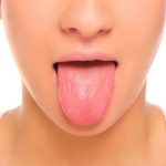 Bolle sulla lingua cause e rimedi
