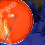 E.coli nelle urine