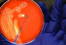 E.coli nelle urine