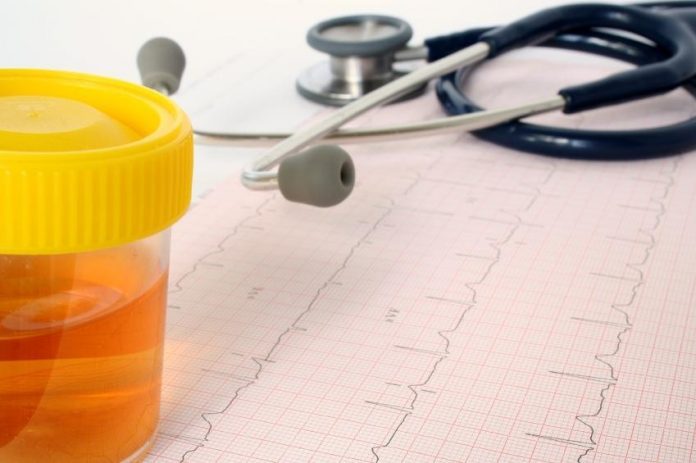 Urine Scure E Maleodoranti Al Mattino