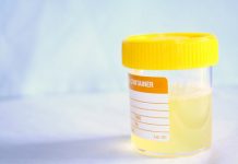 Batteri nelle urine cause
