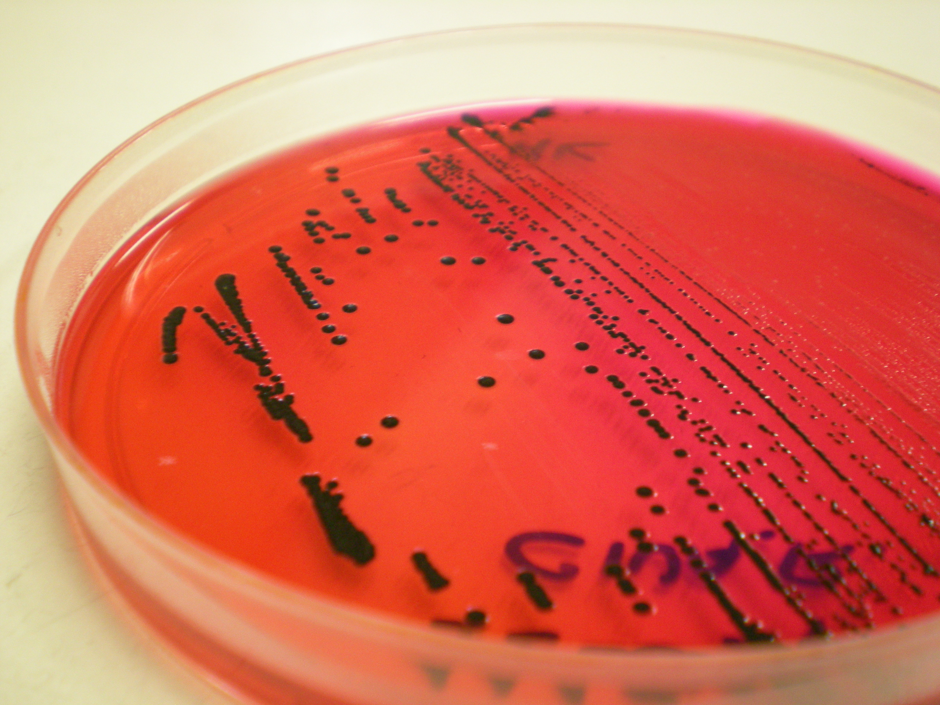 5 сальмонеллез. Сальмонелла (Salmonella). Salmonella SPP, сальмонелла.. Сальмонелла энтерика. Серотипирование сальмонелл.