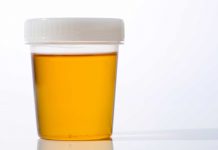 Peso specifico delle urine
