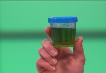 Urina verde