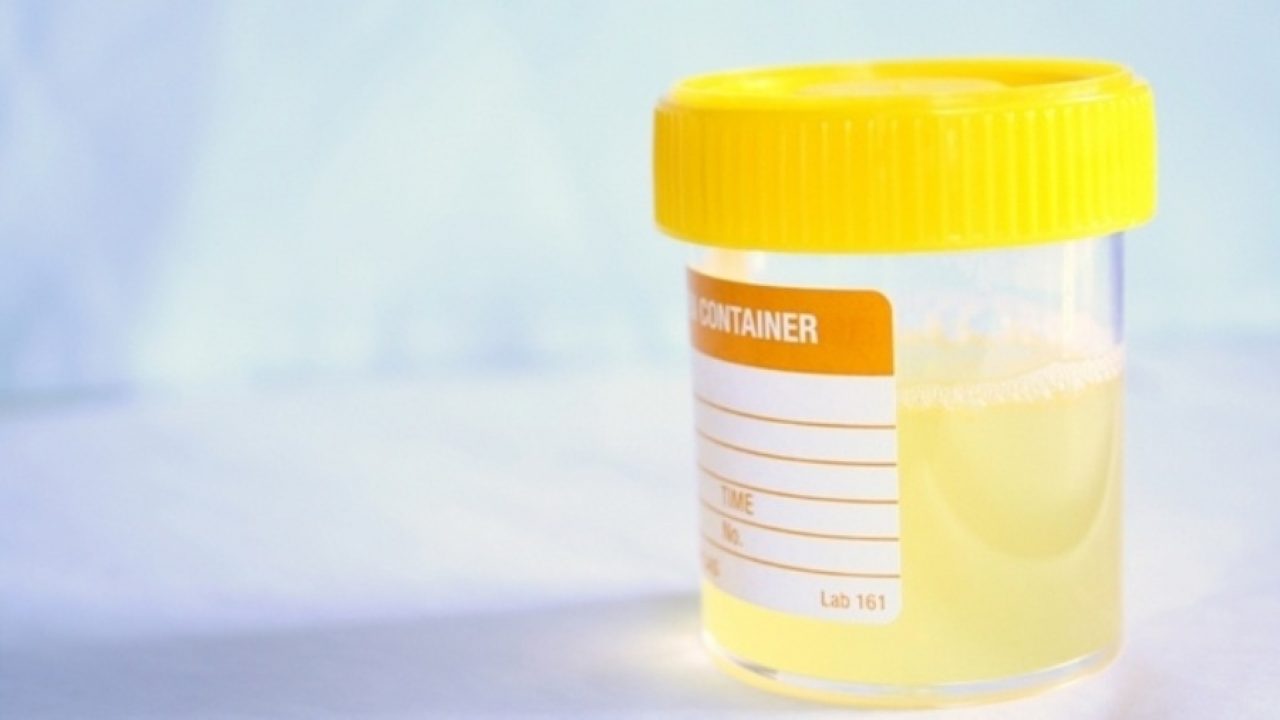 prostatite inoltre sputo nelle urine