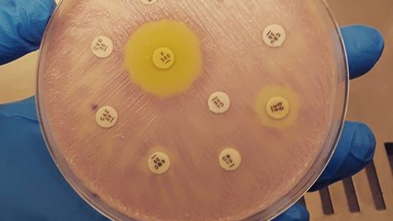 problema di sensibilità delle urine problema di sensibilità delle urine