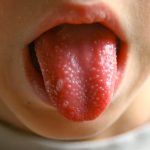 puntini di sangue sulla cappella