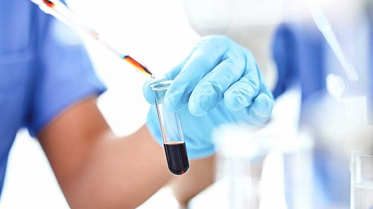 tumore alla prostata potassio