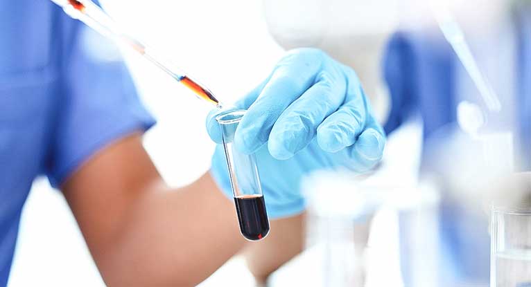 Potassio Alto Scopri le Cause, i Sintomi e Cosa Mangiare!