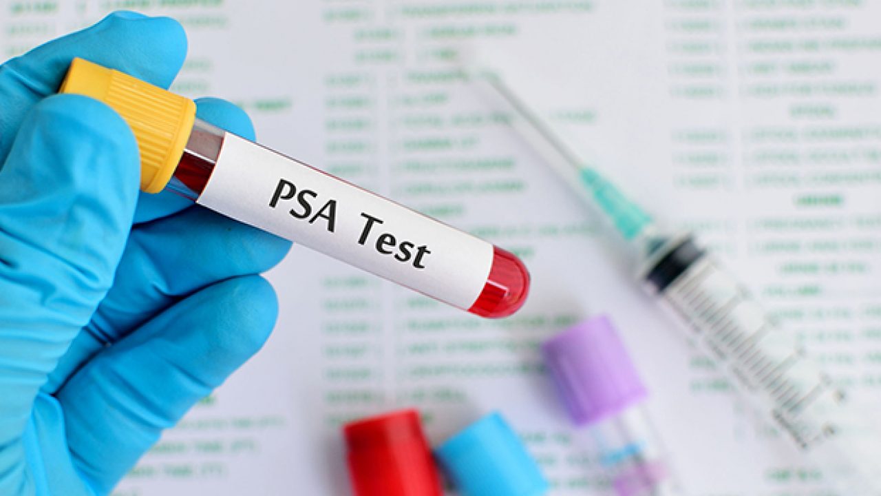 significato di psa della ghiandola prostatica significato di psa della ghiandola prostatica