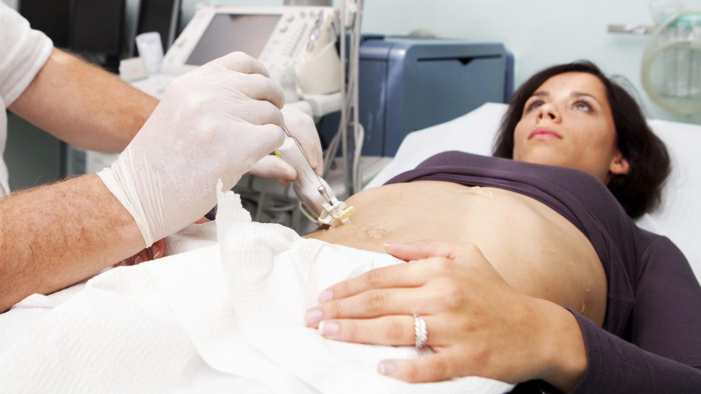 Biopsia Epatica Guida Completa Alla Procedura Complicanze