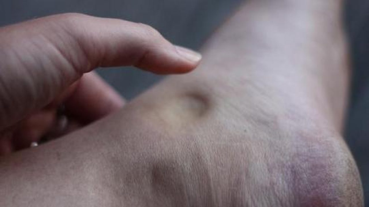 in cosa consiste esame prostata dito nel culo 2017 in cosa consiste esame prostata dito nel culo 2017