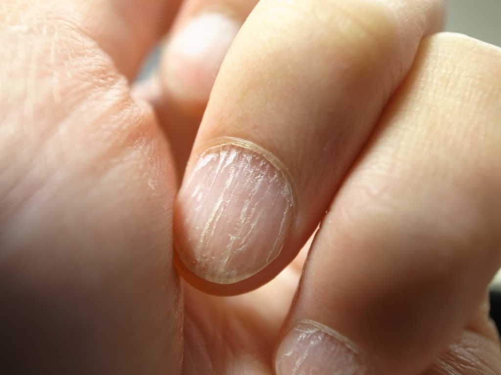 migliore crema antifungina per le mani migliore crema antifungina per le mani