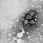 Epatite B: cos'è, quali sono i sintomi e come si cura