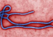 Ebola