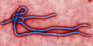 Ebola