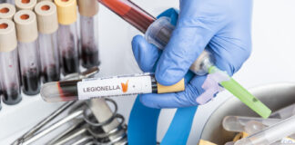 legionella