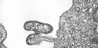 Febbre emorragica di Chapare: cause, sintomi e trattamento