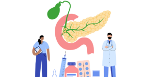 Tumore neuroendocrino pancreas