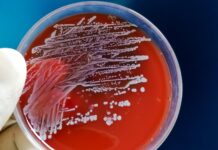 staphylococcus aureus