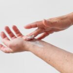 crema cortisone