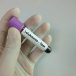 leishmania
