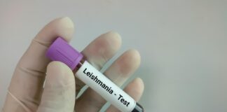 leishmania