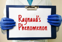 fenomeno o sindrome di raynaud