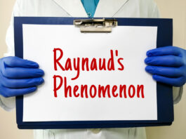 fenomeno o sindrome di raynaud